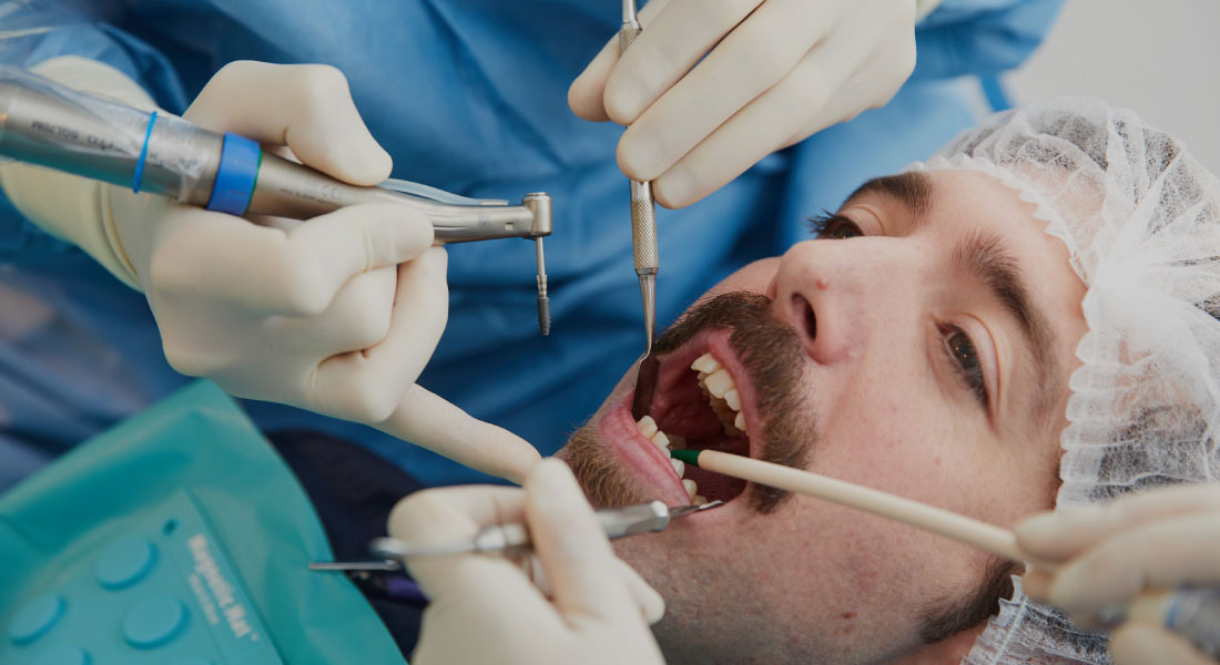 cabinet saint guillaume les dents chez l adulte les implants pose d implants dentaires 02