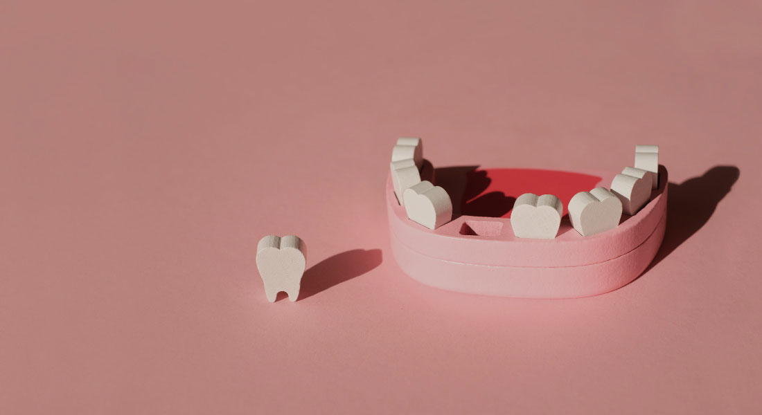 cabinet saint guillaume les gencives le traitement des parodontites dechaussement des dents 02